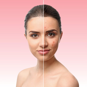 Female client showing dark spots and hyperpigmentation on her face, looking for an even skin tone.