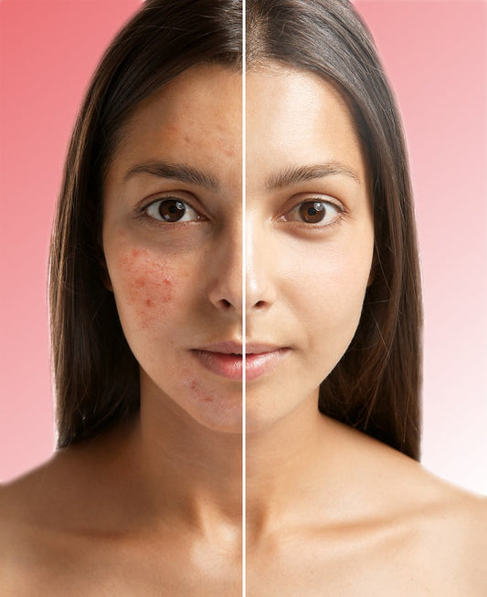 Skin Repair Program